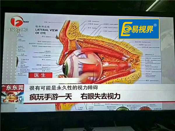 瘋玩手機一天右眼失去視力_易視界