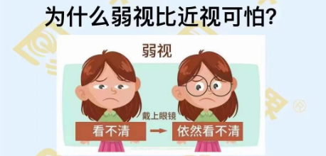 為什么弱視比近視可怕？