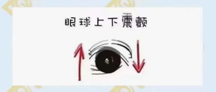 什么是眼球震顫？