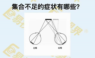 集合不足的癥狀有哪些？